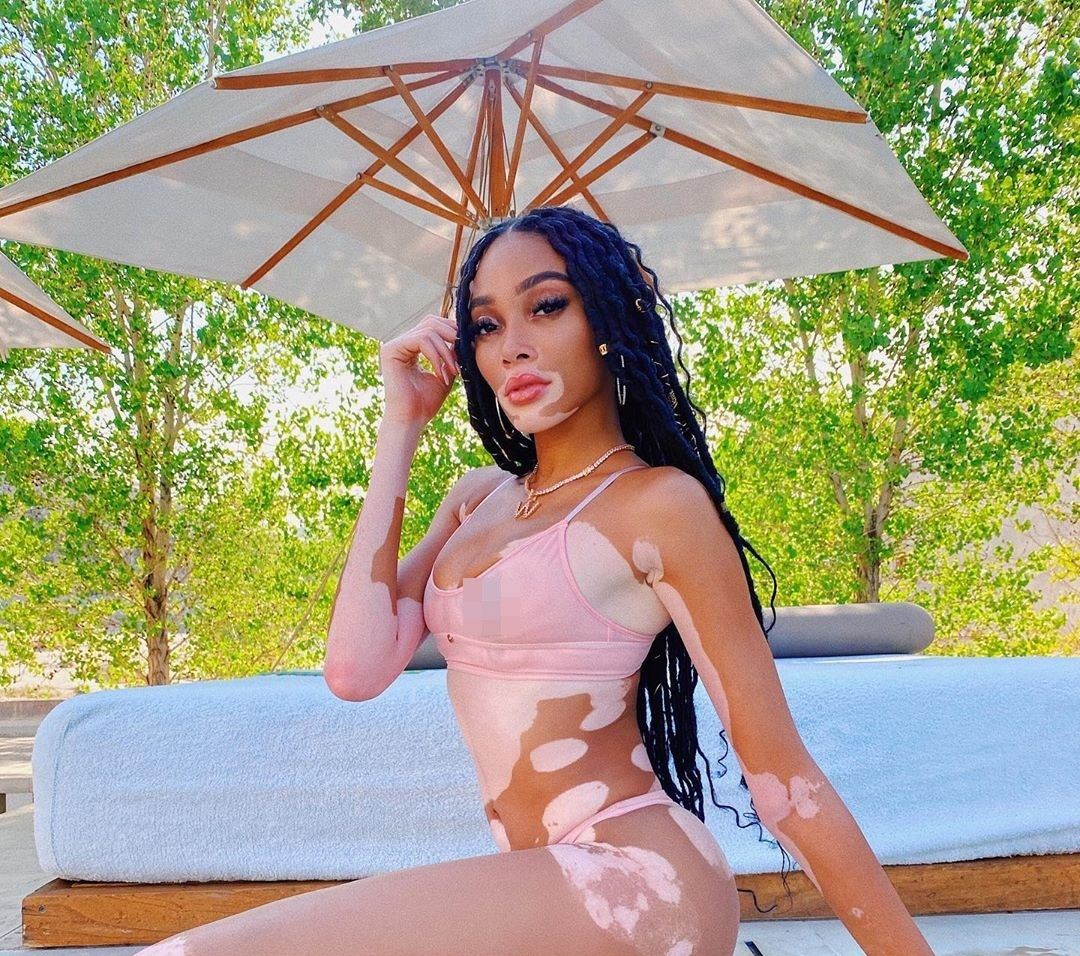 Winnie Harlow thư giãn bên hồ bơi với bikini nhỏ xíu ảnh 3