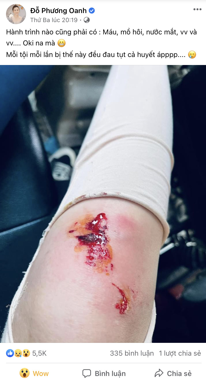 Phương Oanh lại ‘đổ máu’, xứng danh diễn viên lăn xả ảnh 2
