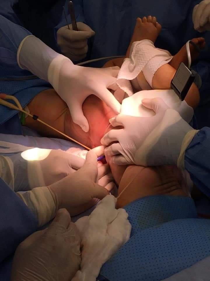 Đã tách thành công hai bé Trúc Nhi - Diệu Nhi dính nhau ảnh 3