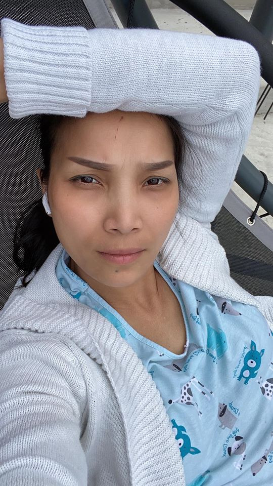 Hồng Ngọc khoe ảnh mặt mộc sau sự cố nổ nồi hơi gây biến dạng tại Mỹ ảnh 1