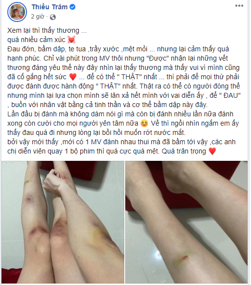 “Bạn gái tin đồn” Sơn Tùng M-TP đăng ảnh tay chân xước xát nặng nề khiến fan lo lắng ảnh 1