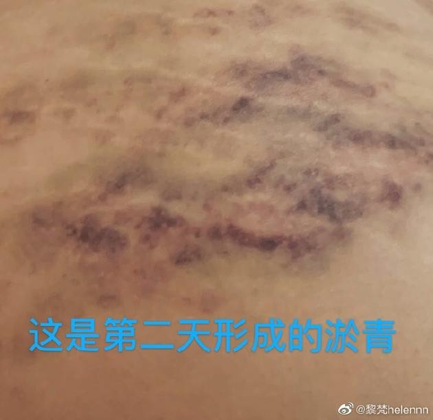 ‘Ngũ A Ca” Khuất Sở Tiêu bị tố bạo dâm, ép bạn gái cũ ký hợp đồng nô lệ ảnh 2