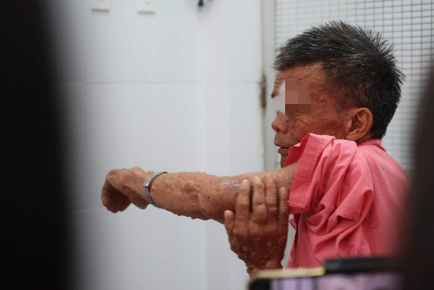 Cứu thầy giáo thoát cảnh mặc quần 'mỗi ống 1 size' vì khối bướu khổng lồ ảnh 3