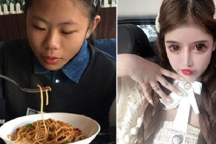 Thiếu nữ 16 tuổi phẫu thuật thẩm mỹ 100 lần trong ba năm ảnh 3