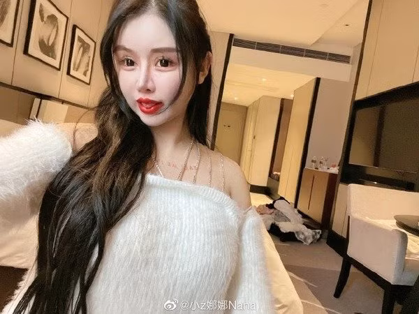 Thiếu nữ 16 tuổi phẫu thuật thẩm mỹ 100 lần trong ba năm ảnh 1