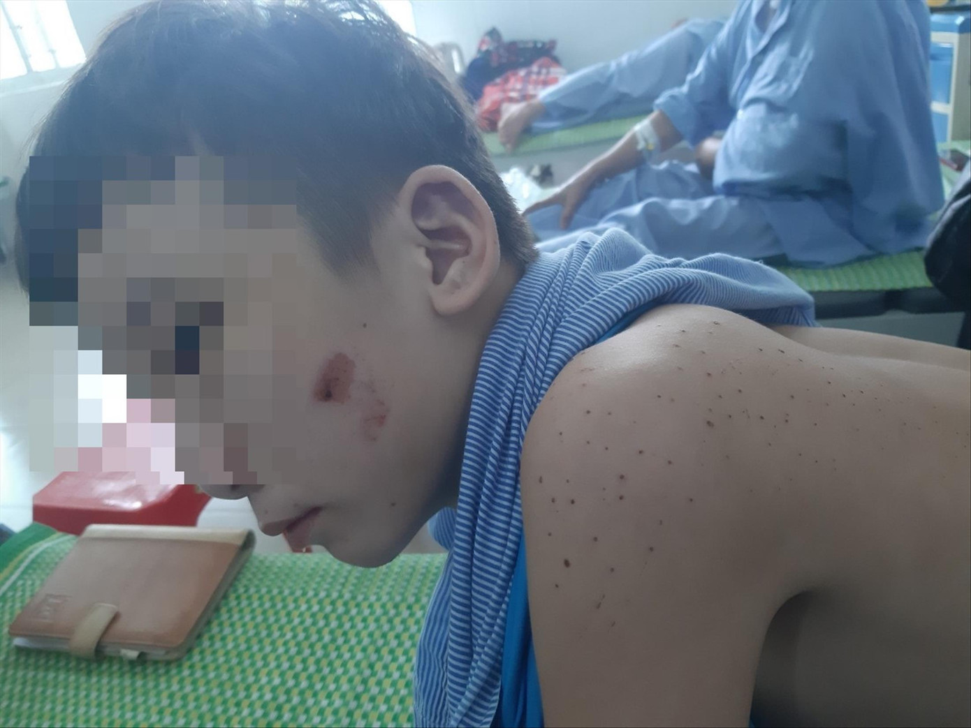 Vụ hai thanh thiếu niên bị chủ quán bánh xèo hành hạ: Hoàn cảnh gia đình éo le ảnh 3