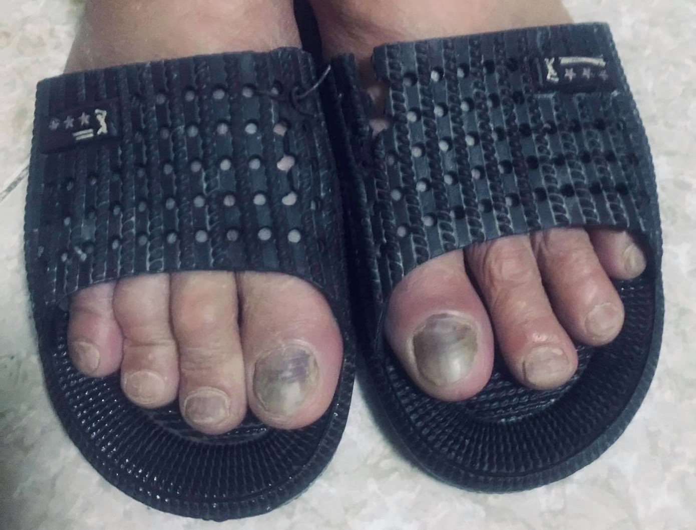 Những đôi chân ứa máu của người dân vùng lũ ảnh 4