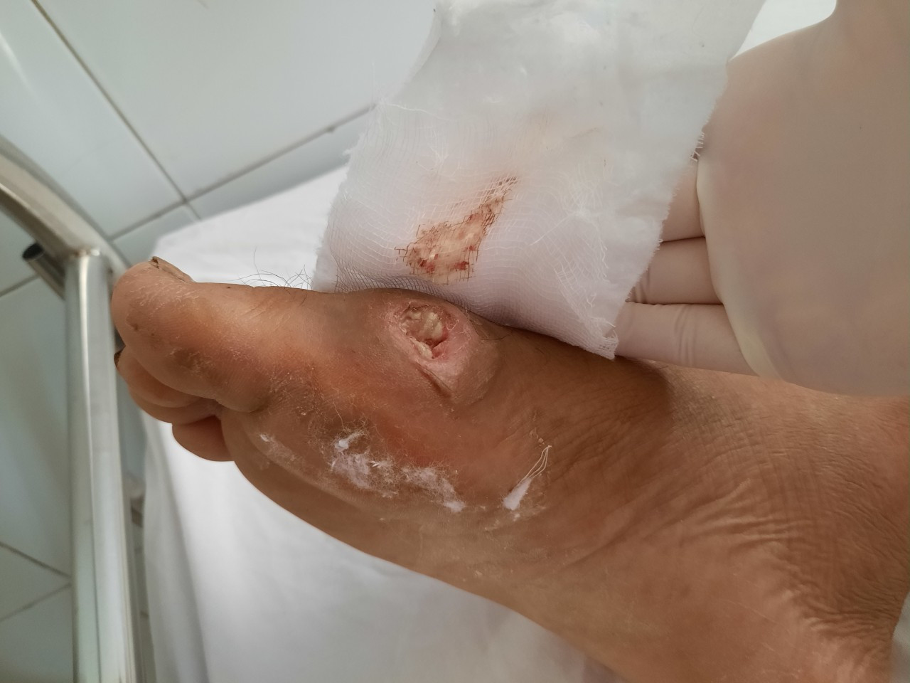 Đà Nẵng: Ca bệnh Whitmore tăng mạnh trong mùa mưa lũ ảnh 2