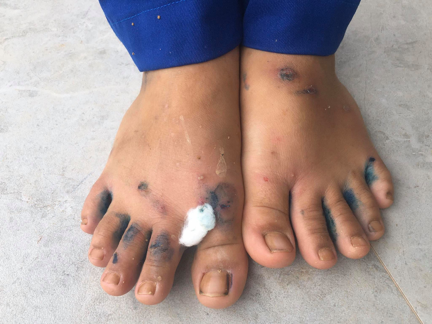 Những đôi chân ứa máu của người dân vùng lũ ảnh 5