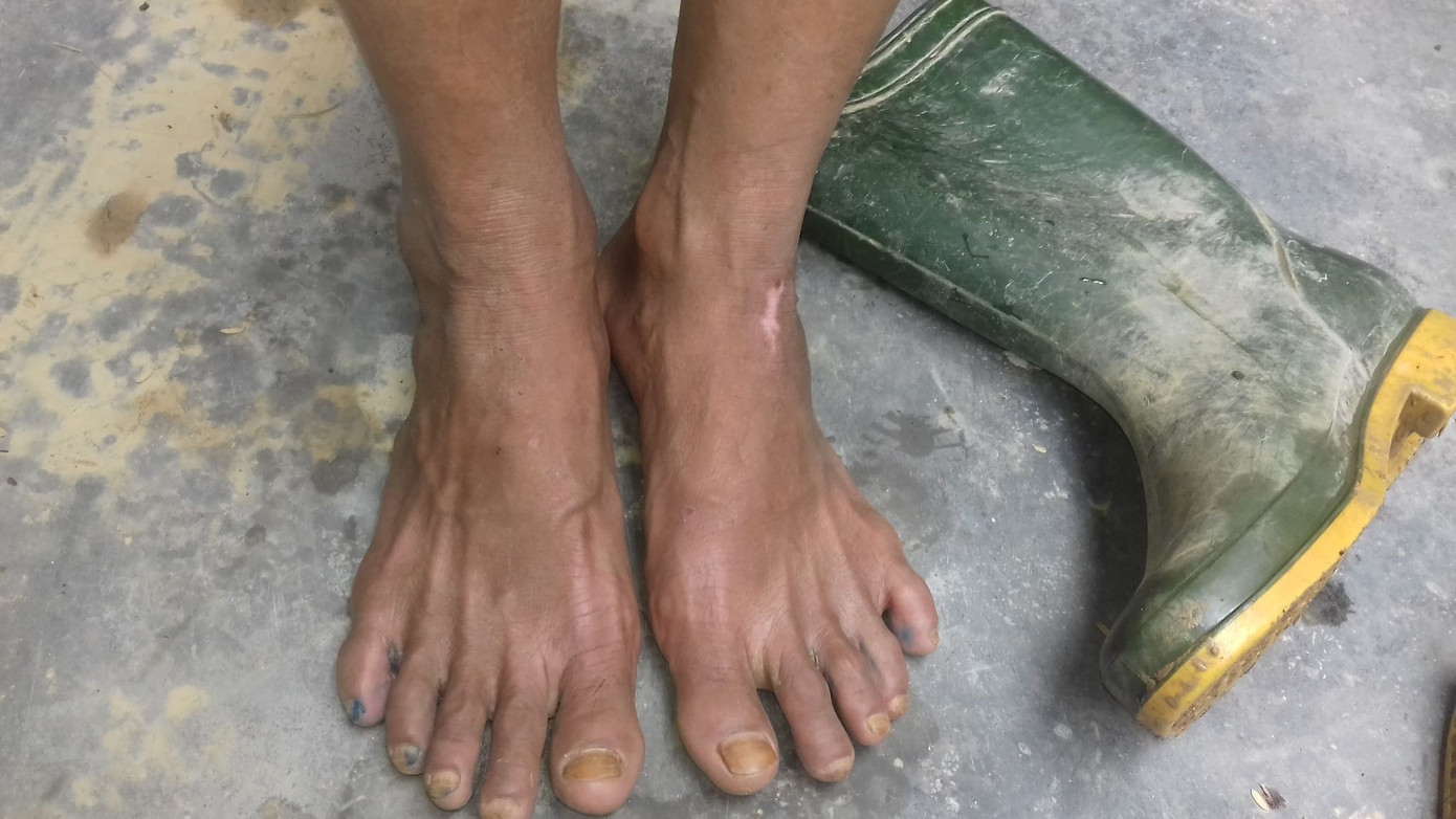 Những đôi chân ứa máu của người dân vùng lũ ảnh 6