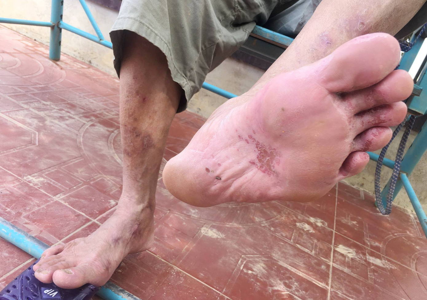 Những đôi chân ứa máu của người dân vùng lũ ảnh 1