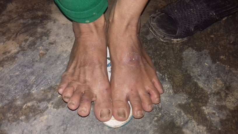 Những đôi chân ứa máu của người dân vùng lũ ảnh 2