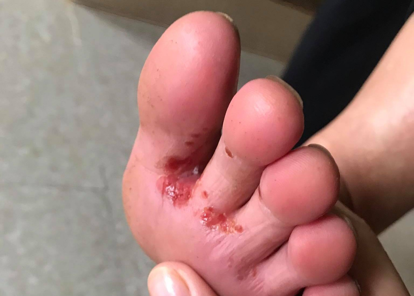 Những đôi chân ứa máu của người dân vùng lũ ảnh 3