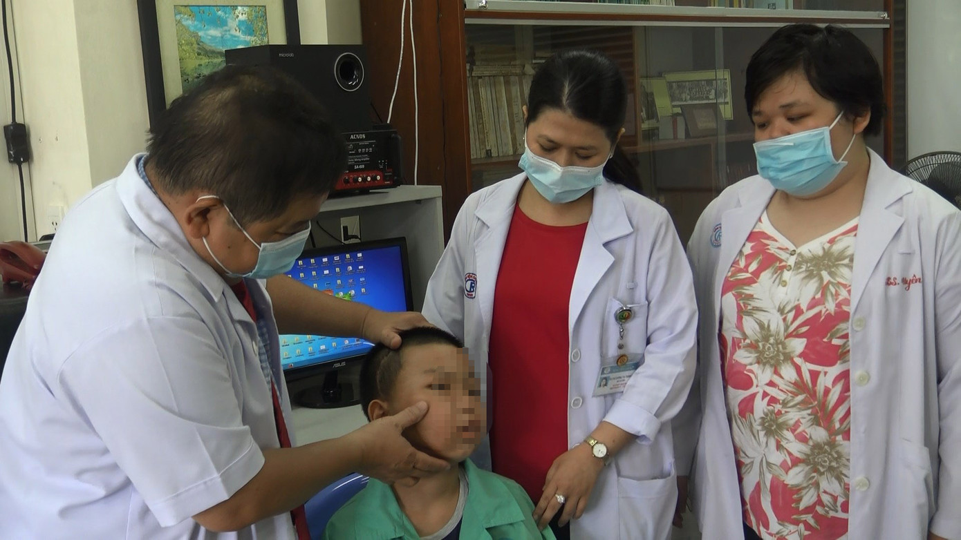 Khối u làm biến dạng khuôn mặt bé trai 13 tuổi lần đầu phát hiện ở Việt Nam ảnh 1