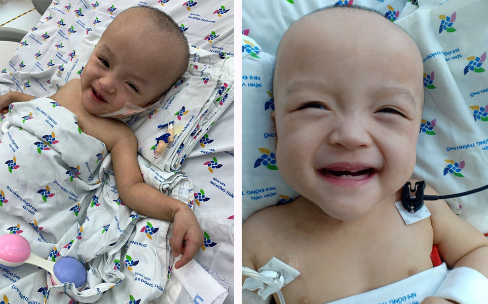 Trúc Nhi – Diệu Nhi tự cầm bình sữa uống sau 20 ngày được mổ tách rời ảnh 1