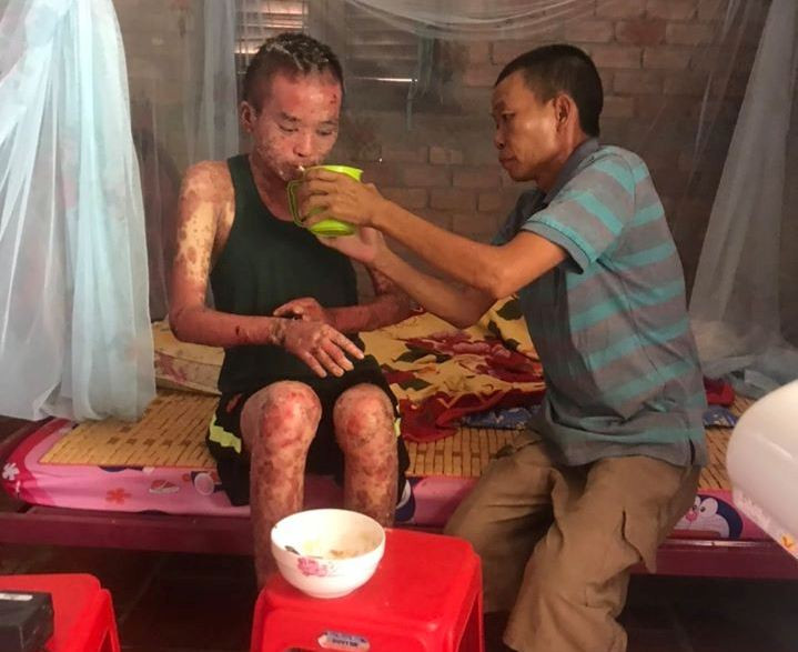 Trường ĐH Văn Hiến kêu gọi ủng hộ cho sinh viên bị bệnh nặng ảnh 1