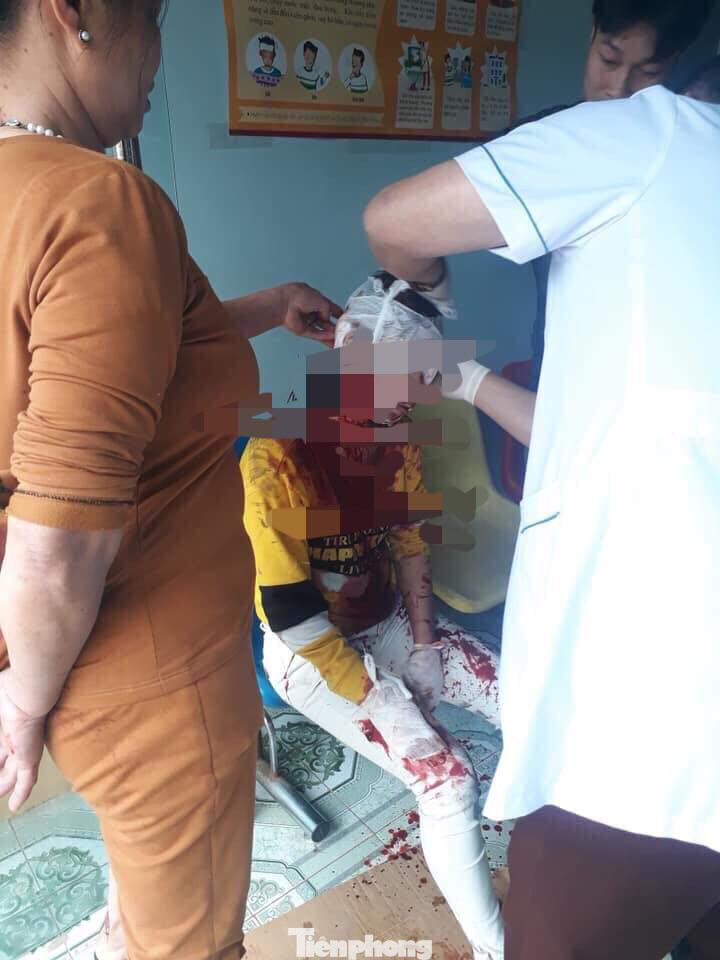 Hàn gắn tình cảm không xong, chồng vung dao chém vợ rồi uống thuốc sâu tự tử ảnh 1