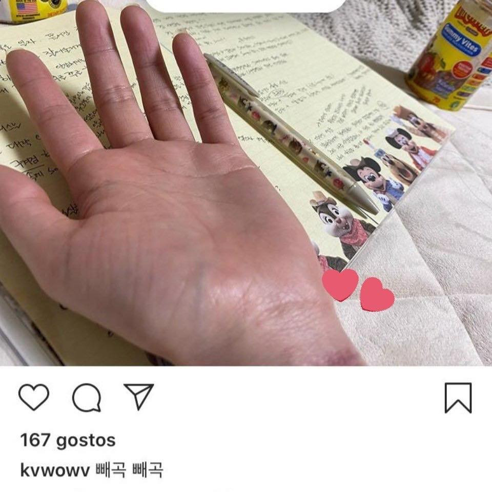 Mina (cựu thành viên AOA) đăng ảnh cổ tay hằn vết sẹo khiến fan hoang mang ảnh 3