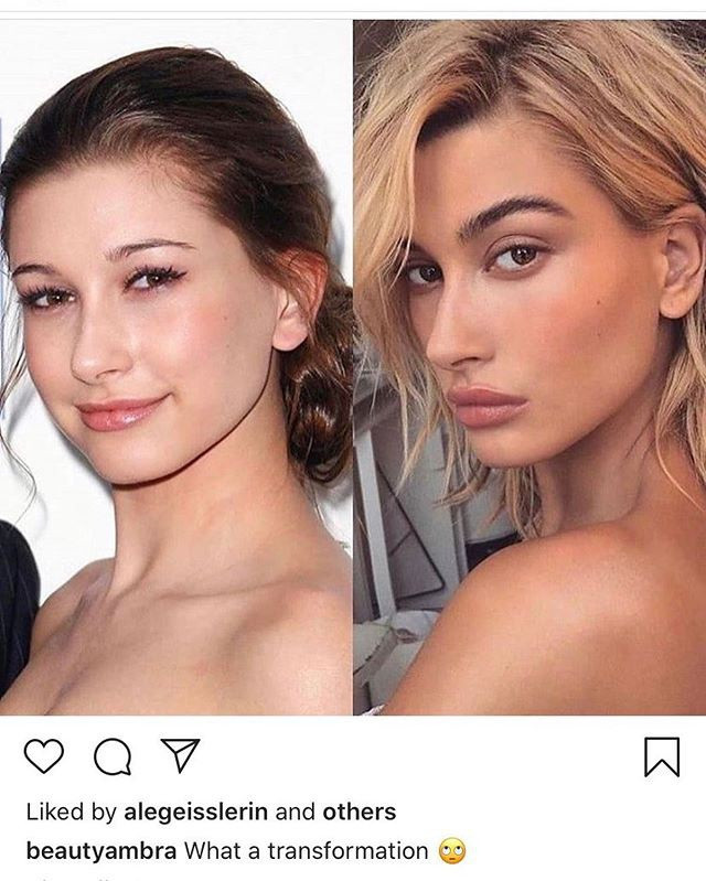 Bà xã của Justin Bieber tức giận, “phản pháo” tin đồn phẫu thuật thẩm mỹ ảnh 1