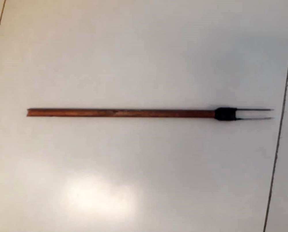 Đuổi theo kẻ trộm chó, nam sinh viên bị bắn tên xuyên cổ ảnh 2