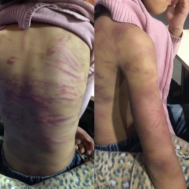 Hai người xâm hại, bạo hành bé gái 12 tuổi ở Hà Nội bị khởi tố ảnh 2