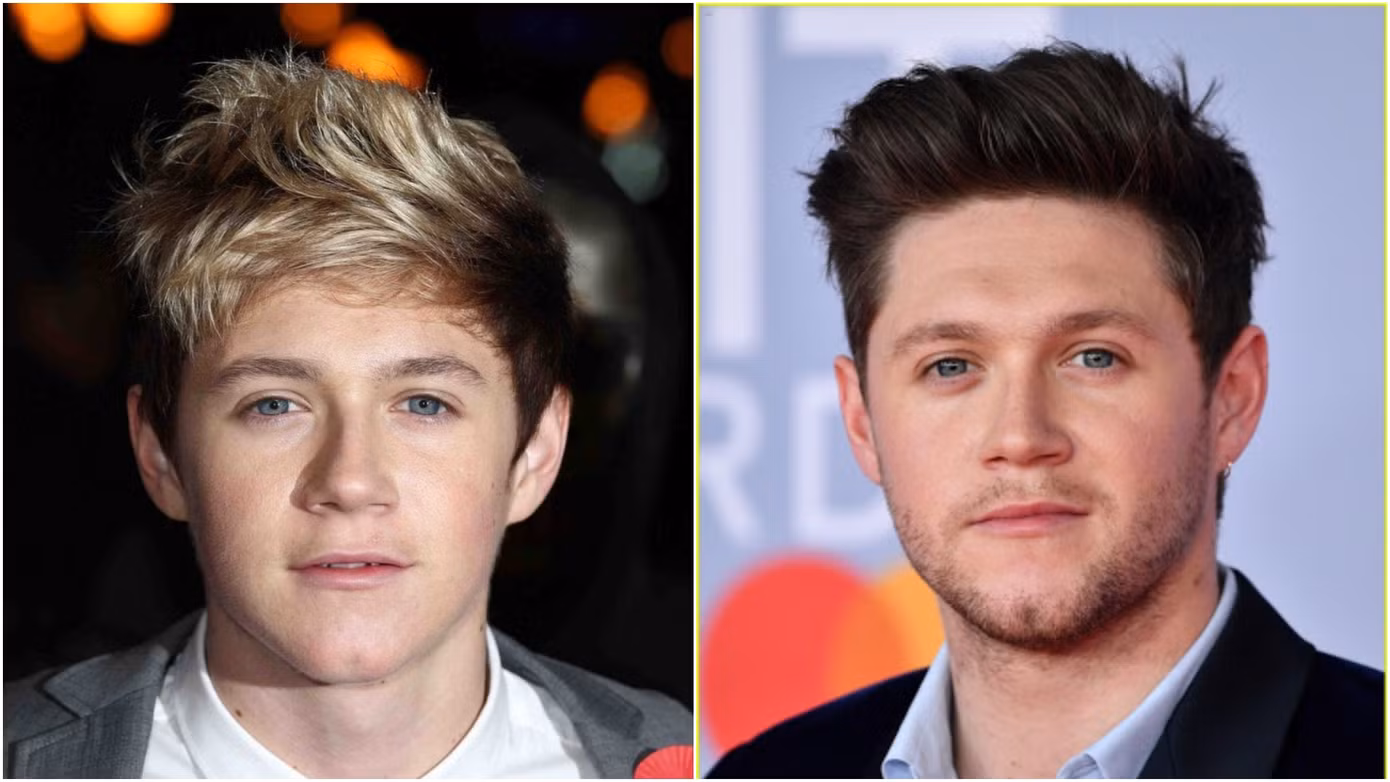 Nhìn lại nhan sắc dàn “nam thần thanh xuân” nhóm One Direction sau 10 năm ảnh 3