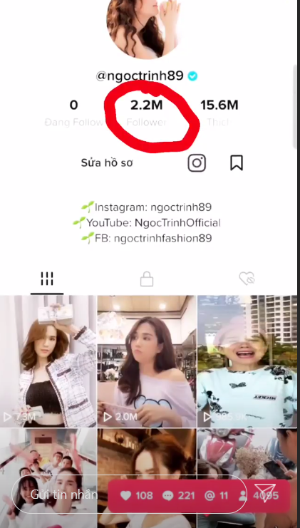 Song Luân nhập viện, thở oxy trong tình trạng nguy kịch? ảnh 4