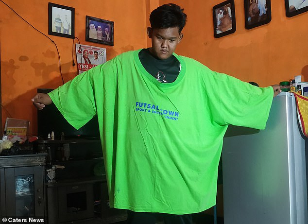 Đứa trẻ béo nhất thế giới với 190kg giảm cân ngoạn mục ảnh 7