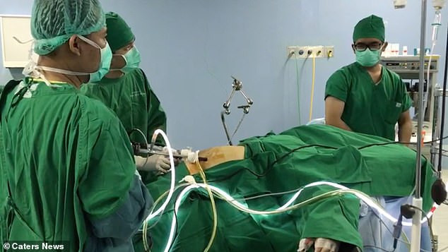 Đứa trẻ béo nhất thế giới với 190kg giảm cân ngoạn mục ảnh 4