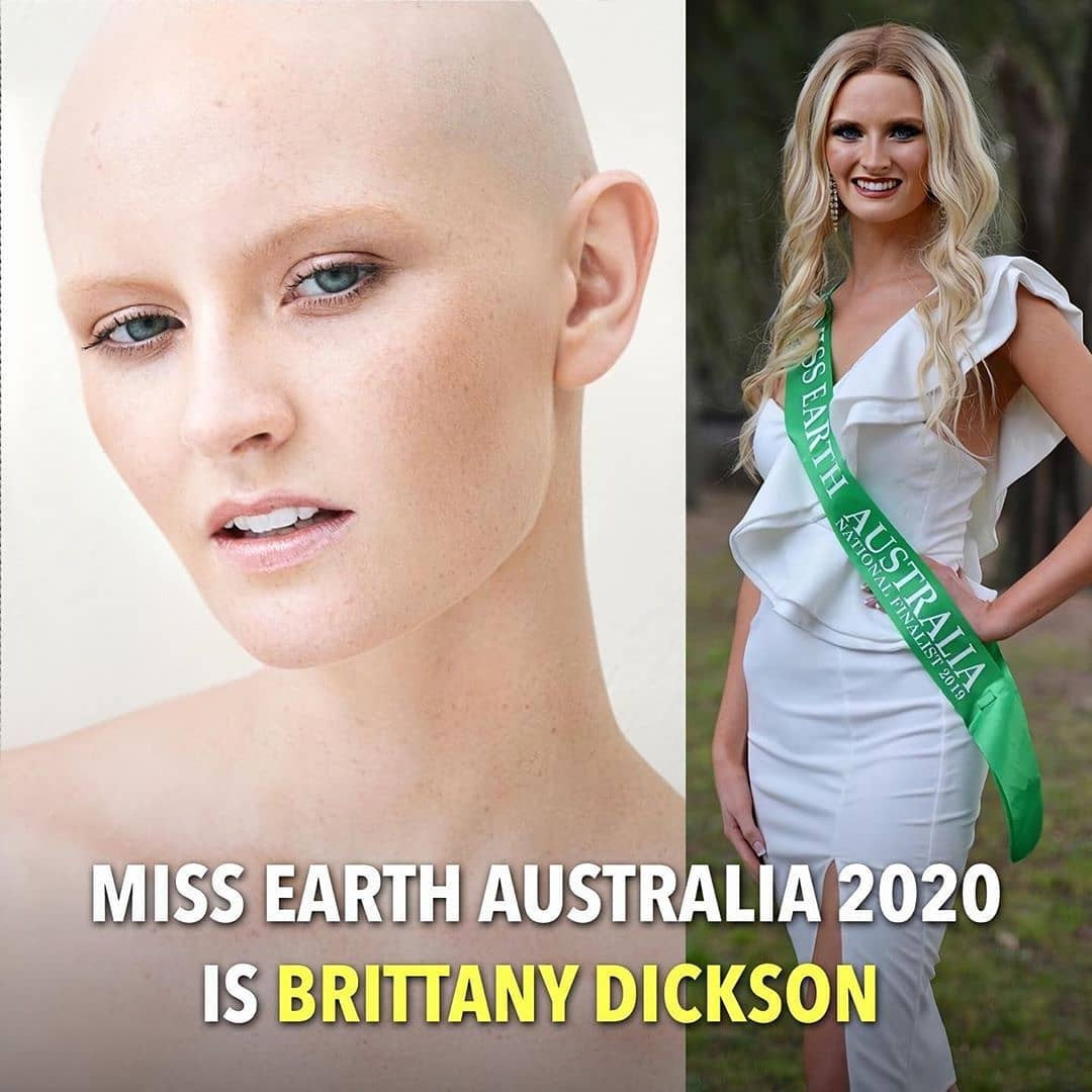 Cô gái từng chiến thắng bệnh ung thư não lên ngôi Hoa hậu Trái đất Úc 2020 ảnh 1