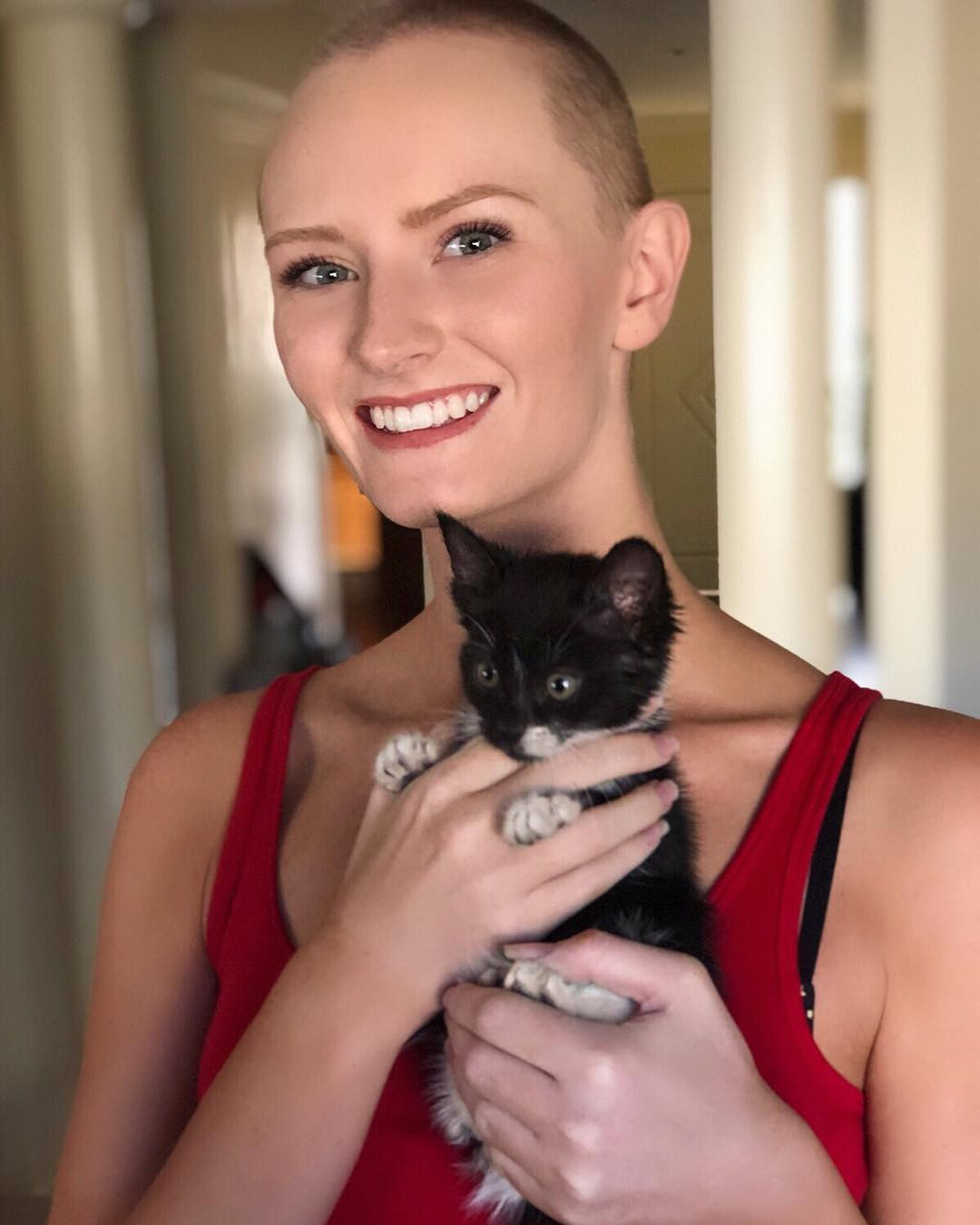 Cô gái từng chiến thắng bệnh ung thư não lên ngôi Hoa hậu Trái đất Úc 2020 ảnh 4