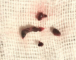 Đột qụy ở sân bay Tân Sơn Nhất, người đàn ông may mắn được cứu sống ảnh 1