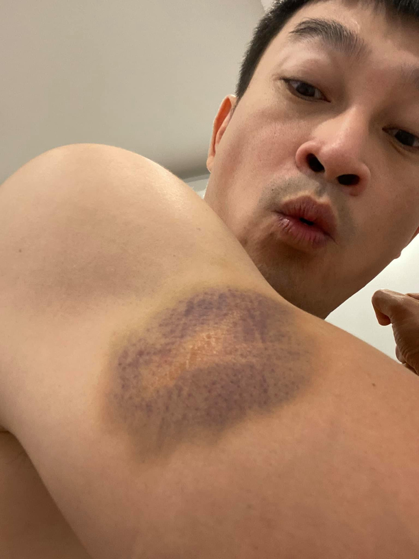 Diễn viên Quốc Thái lên tiếng về việc bị tủ rơi trúng đầu ảnh 2