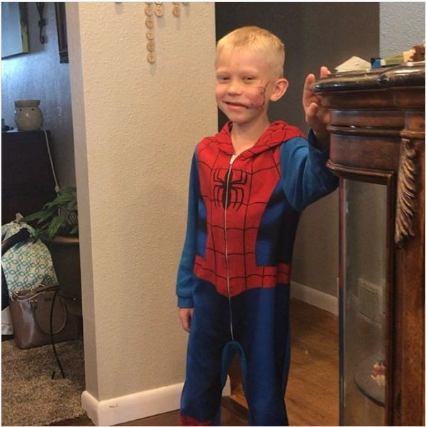 Tom Holland mời cậu bé bị chó cắn vì cứu em gái đến phim trường “Spider-Man 3” ảnh 2