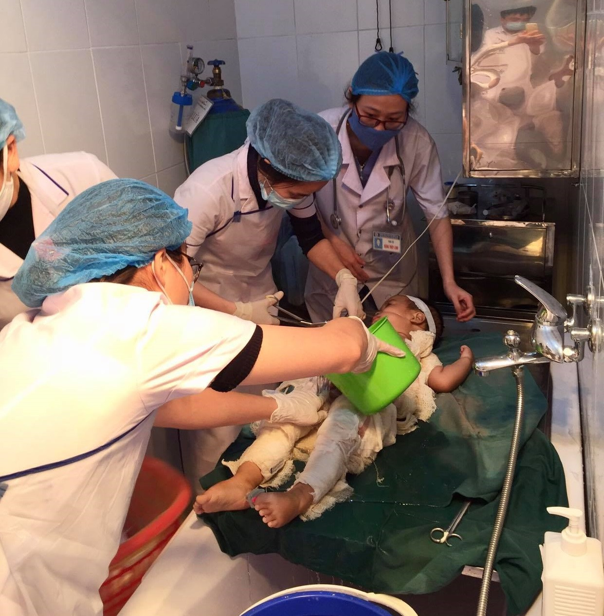 Bé trai bị nhiễm trùng nặng khi chữa bỏng bằng nước mắm và rượu ảnh 1