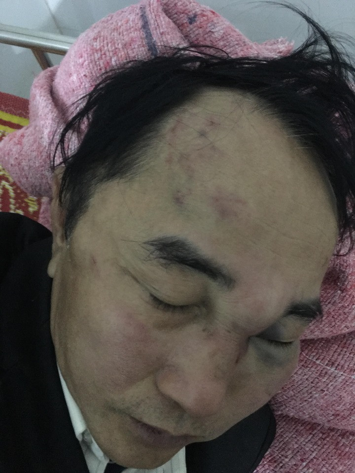 Nam bác sỹ bị đánh hội đồng do mâu thuẫn chỗ đỗ xe ảnh 1