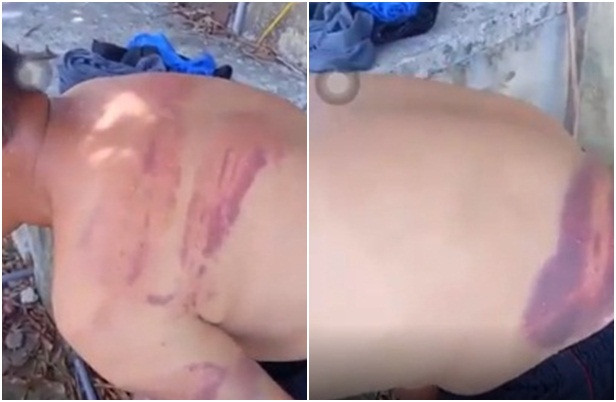Dư luận bức xúc clip người đàn ông mù bị nhiều vết thương bầm tím ảnh 1