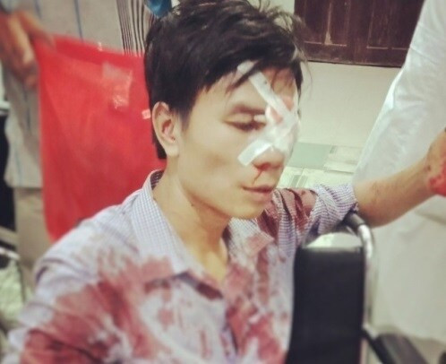 Cán bộ địa chính bị tố dùng xẻng đánh người nhập viện sau va chạm giao thông ảnh 1