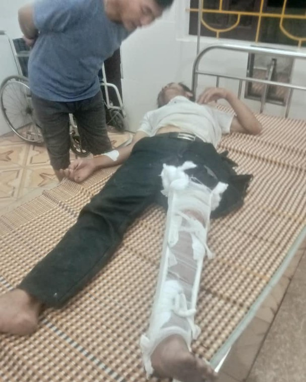 Hai xe máy va chạm, 4 người trong gia đình bị thương nghiêm trọng ảnh 1