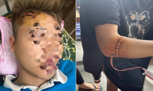 Mâu thuẫn khi đi chúc Tết, nhóm côn đồ xông vào nhà dân chém người ảnh 2