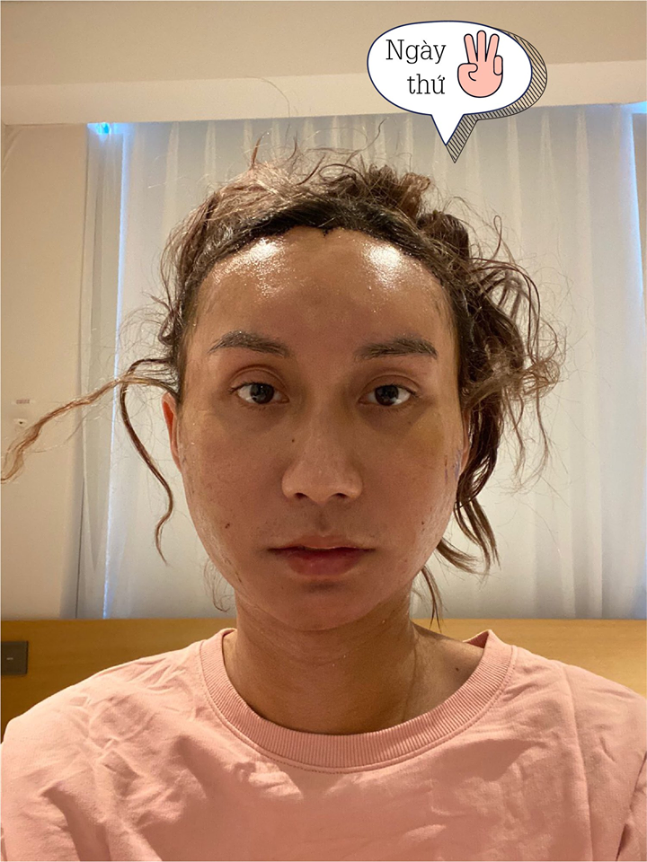 Lynk Lee chính thức công khai quá trình chuyển giới đầy đau đớn ảnh 3