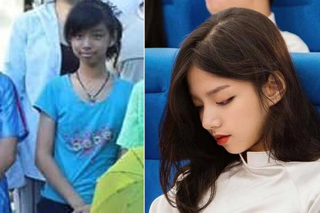 Nhờ niềng răng, cô bé đen nhẻm lột xác thành hot girl khai giảng ảnh 1