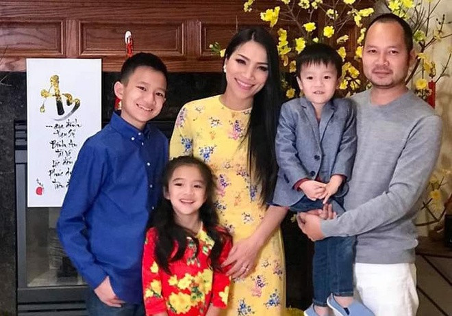 Ca sĩ Hồng Ngọc thay da sau khi bị bỏng vì nổ nồi xông hơi ảnh 2