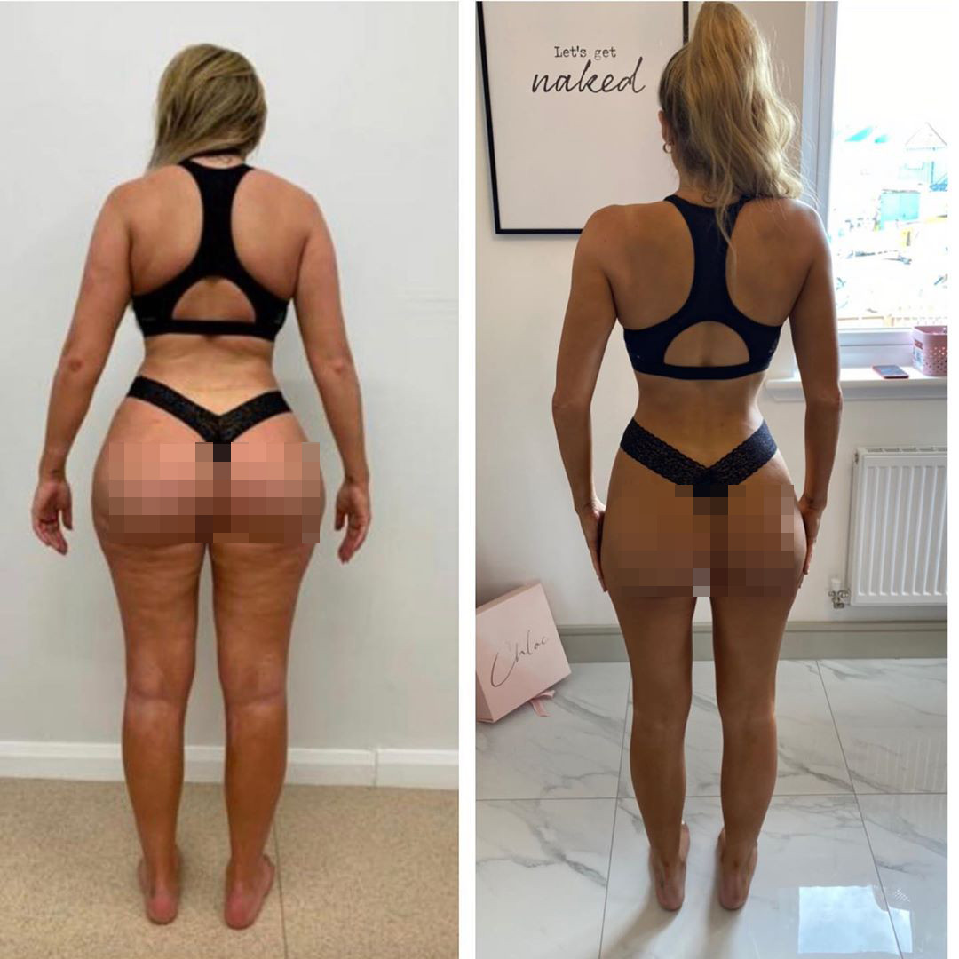 ‘Mỹ nhân dao kéo’ Chloe Ferry khoe đường cong ‘bốc lửa’ với nội y ren bé xíu ảnh 7