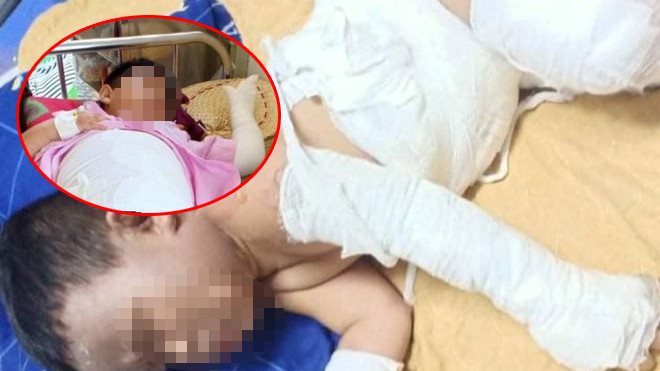 Bắt nhóm đối tượng phóng hỏa khiến 2 bé trai bỏng nặng ảnh 1