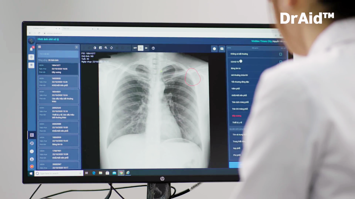 VinBrain lọt vòng chung kết cuộc thi toàn cầu “Thử thách ứng phó với đại dịch” ảnh 2