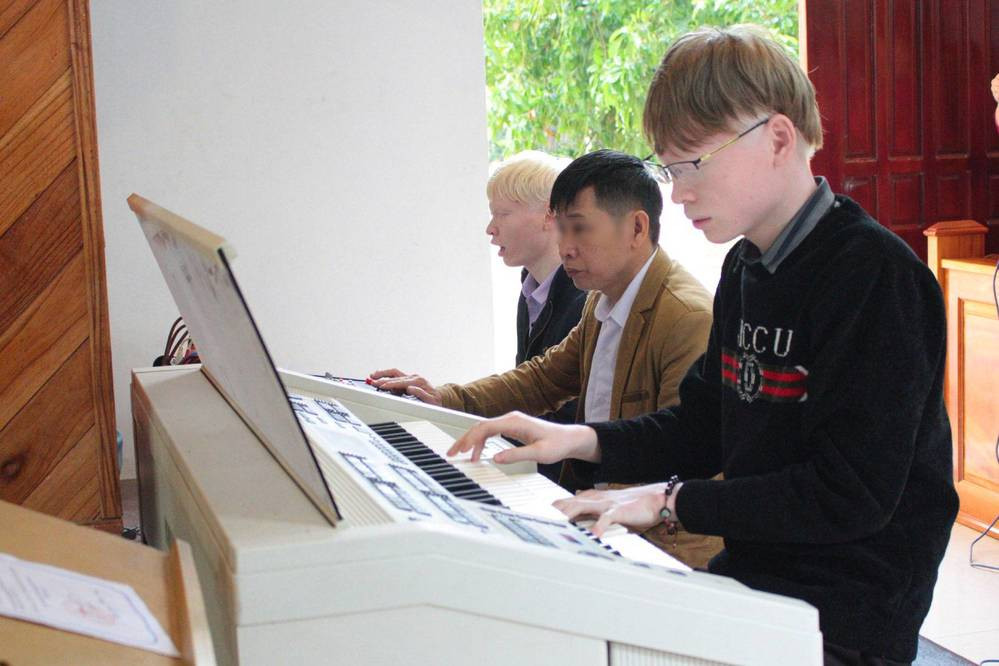 Cặp anh em bạch tạng hiếm hoi: Sự khác biệt chưa bao giờ là trở ngại ảnh 7