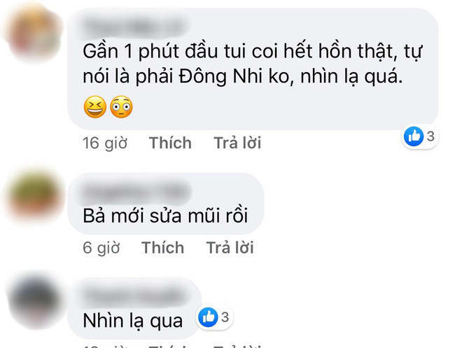 Đám cưới chưa bao lâu, Đông Nhi dính ngay nghi án phẫu thuật thẩm mĩ ảnh 4