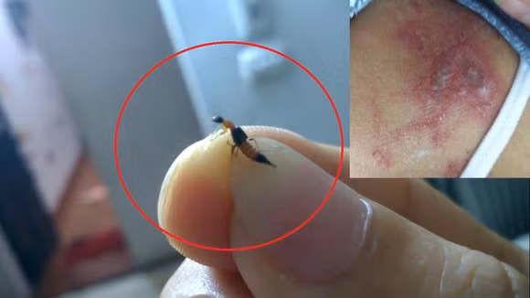 Sắc màu SV 30/6: Bản sao Jisoo bất ngờ nổi tiếng, kiến ba khoang tấn công ký túc xá ảnh 7