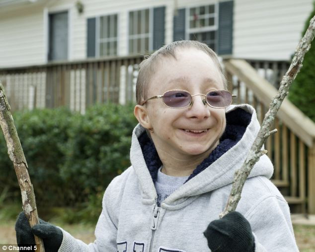 Chàng lùn 28 tuổi cao 86cm, nặng 13kg: Sống lạc quan, tích cực từng ngày, cho dù bệnh tật ảnh 8